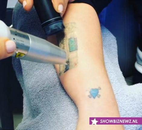 kelly-osbourne-laat-tattoo-weglaseren