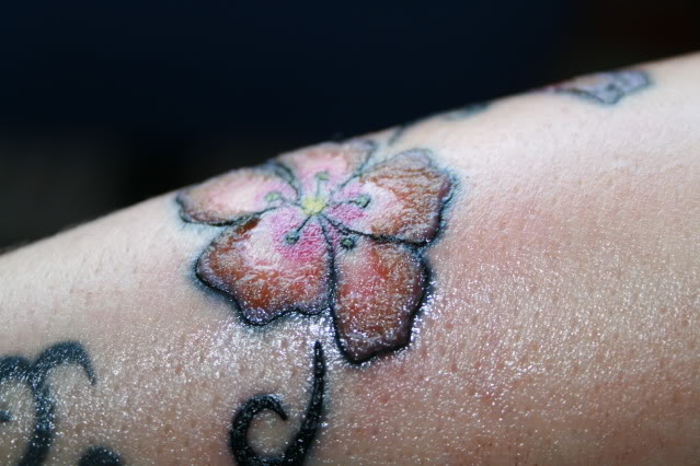 Tattoo allergie