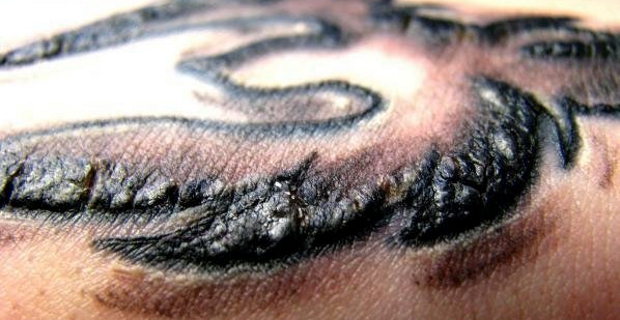 Tattoo gevaren en risico's