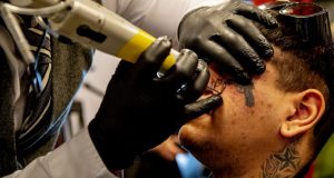 werklozen-laten-gratis-tatoeages-weghalen-bij-de-erasmus-universiteit